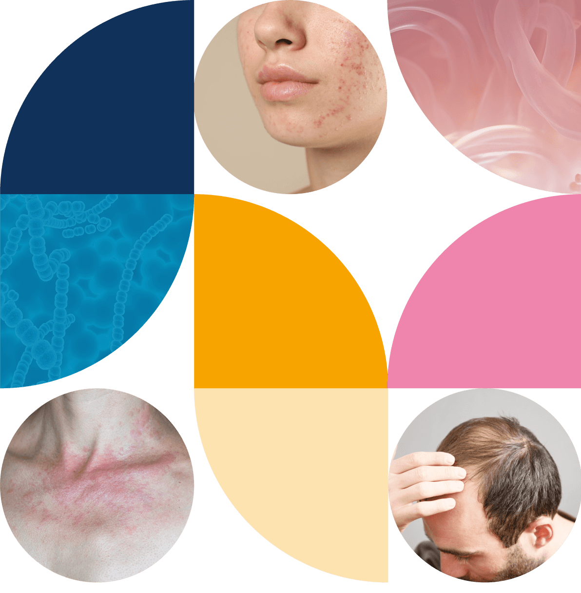 Collage de imágenes médicas relacionadas a microbiota y dermatología